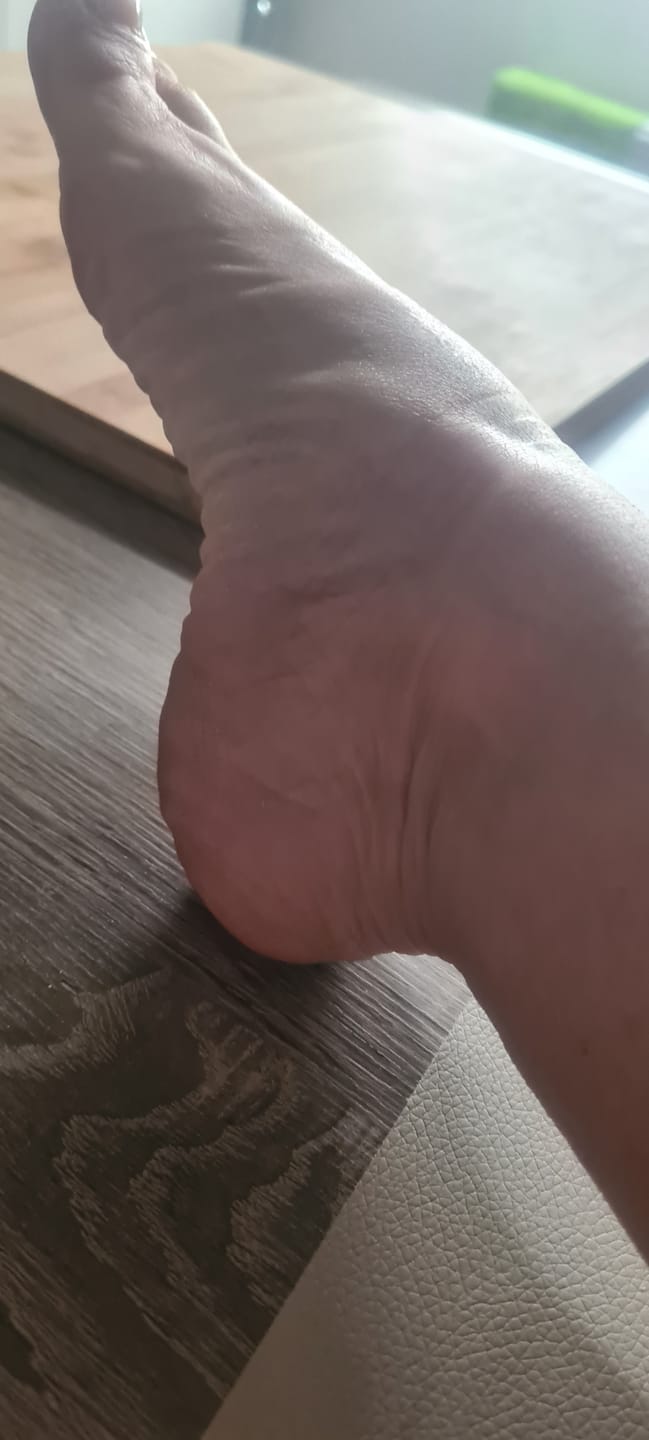 Review by Méline