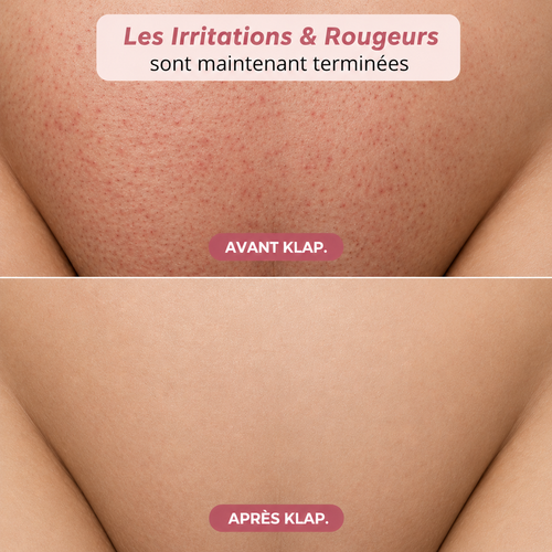 Rasoir Klap