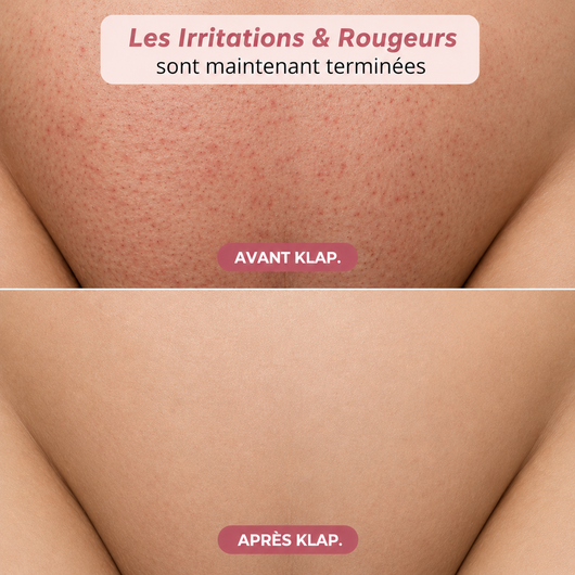 Rasoir Klap